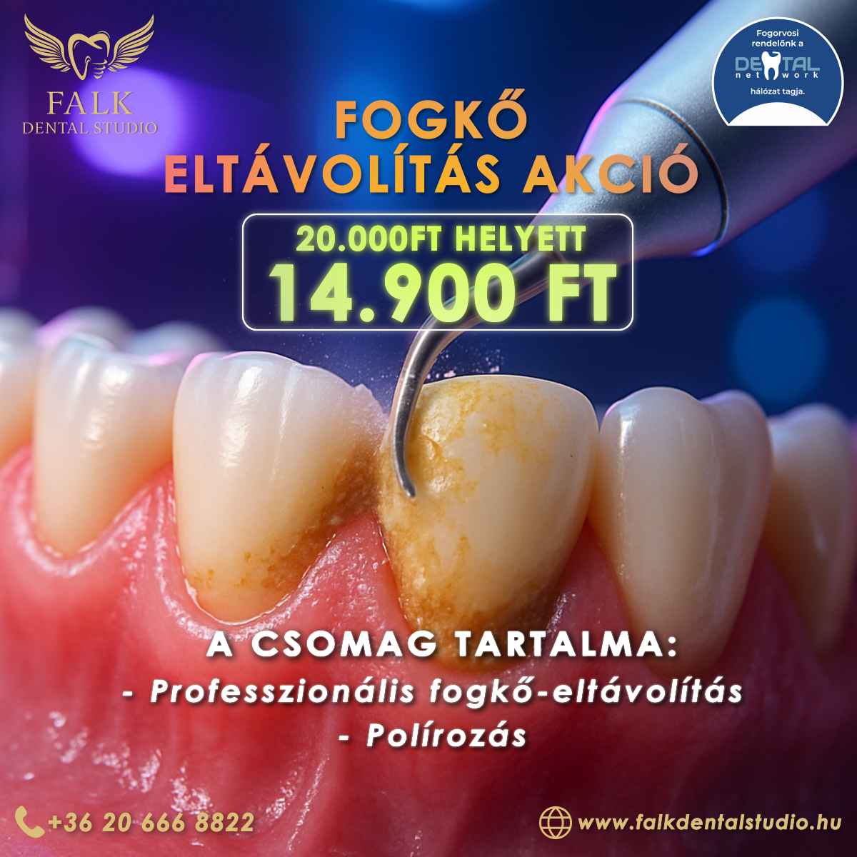 Fogkő eltávolítás AKCIÓ