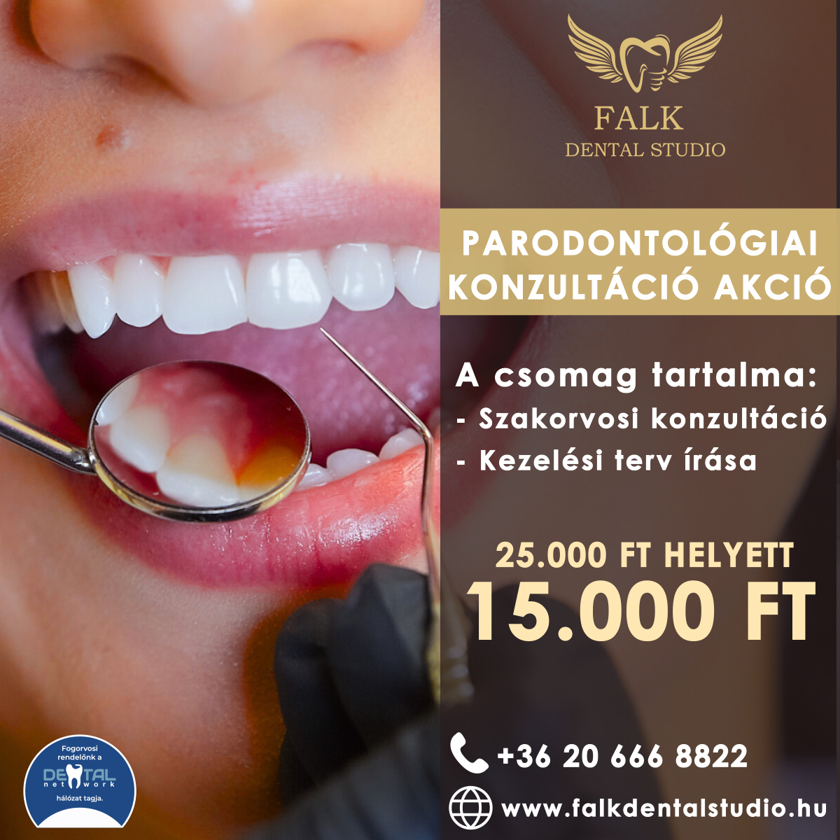 Parodontológiai konzultáció akció
