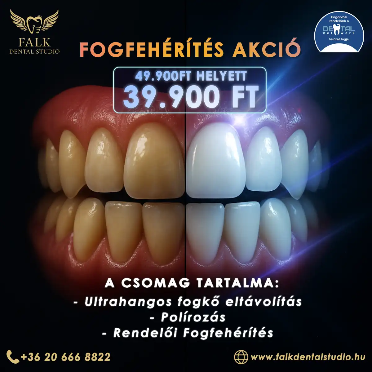 Fogfehérítés AKCIÓ