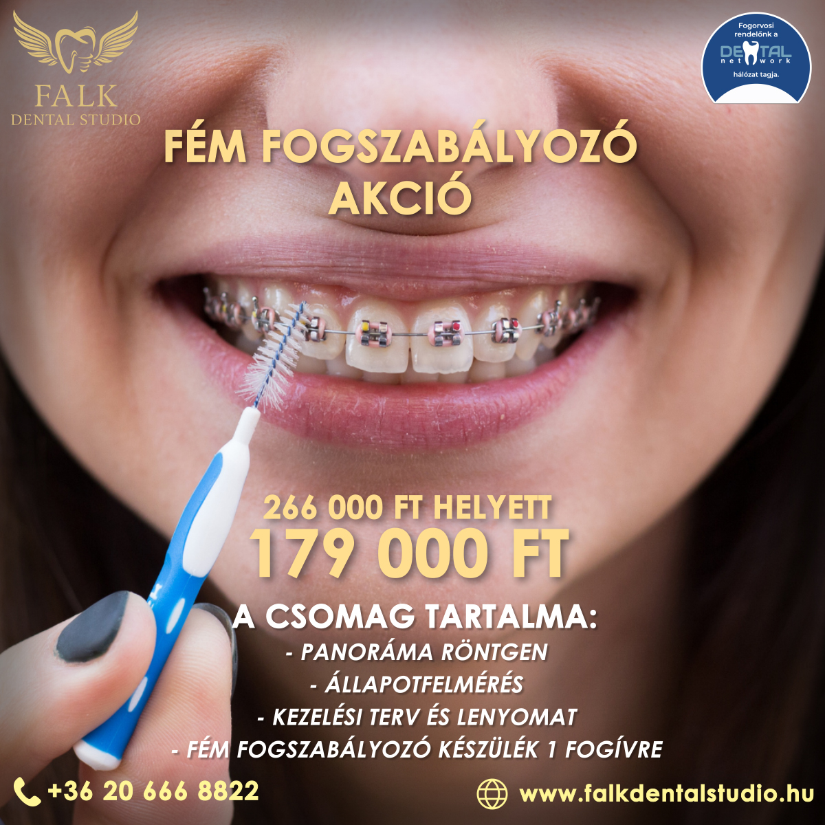 Fém Fogszabályozó Akció