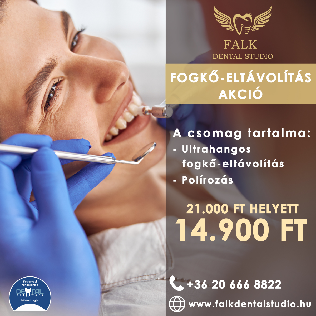 Fogkő-eltávolítás AKCIÓ